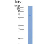 人糖原合酶激酶3β(GSK3b)重组蛋白His tag