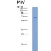 人糖原合酶激酶3β(GSK3b)重组蛋白His tag