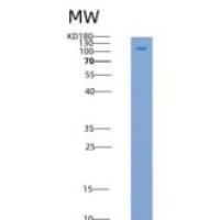 人PFK1 / PFKM重组蛋白His & GST tag