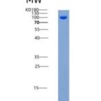 人DCAMKL1 / DCLK1重组蛋白aa 1-705, His & GST tag