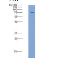 人DAPK3 / ZIPK重组蛋白GST tag