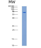人MUSK Kinase重组蛋白aa 433-783, Hi
