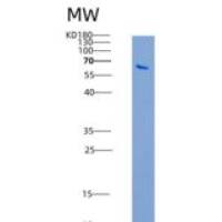 人IL-1RAcP / IL-1R3重组蛋白His & Fc tag