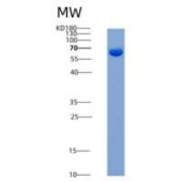 人CSNK2A2 / CK2A2重组蛋白His & GST tag