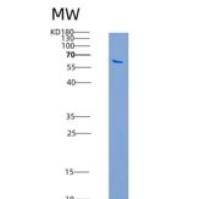 人CAMK1D / CKLiK重组蛋白GST tag