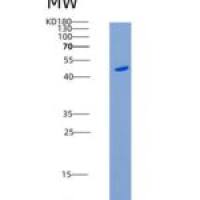 人酪蛋白激酶1γ2(Casein Kinase 1 gamma 2)重组蛋白His Tag