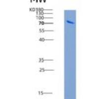 人PLK1 / PLK-1重组蛋白His tag