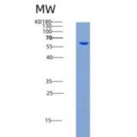 人腺苷激酶(ADK)重组蛋白His & GST tag