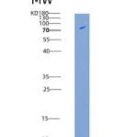 人CAMK1G / CLICK III / CaMKIgamma重组蛋白His & GST tag