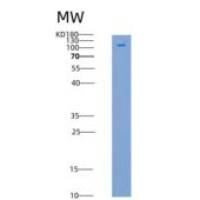 人CDK7 & CCNH & MNAT1 Heterotrimer重组蛋白