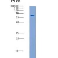 人TRIB3 / TRB3重组蛋白GST tag