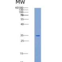 人DR6 / TNFRSF21重组蛋白His tag
