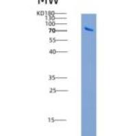 人CAMK2A / CAMKA重组蛋白GST tag
