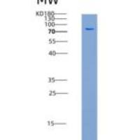 大鼠MMP-9 / CLG4B重组蛋白His tag