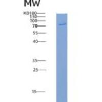 小鼠CHK1 / CHEK1重组蛋白His & GST tag