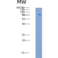人ABL1 / JTK7 / p150重组蛋白GST tag