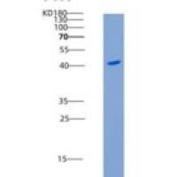 人EDAR / DL重组蛋白Fc tag