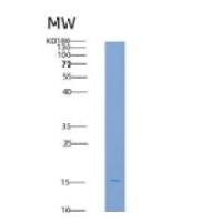 人KIM-1 / TIM1 / HAVCR1重组蛋白aa 1-135, His tag