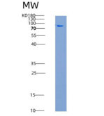 人EphB1 / EPHT2重组蛋白aa 565-984, 