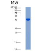 人IL-1R9 / IL1RAPL2重组蛋白His tag