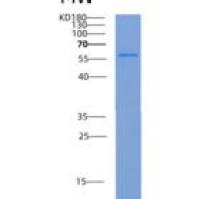 人PKM2重组蛋白His Tag