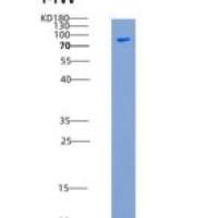 人c-Yes / YES1重组蛋白His & GST tag