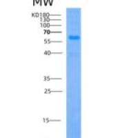 人B-淋巴酪氨酸激酶(BLK)重组蛋白GST Tag