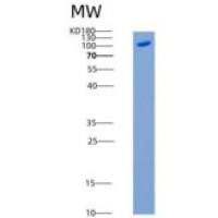 人MAP4K5 / MEKKK5重组蛋白His & GST tag