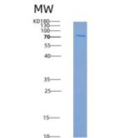 人EphB4 / HTK重组蛋白aa 563-987, His & GST tag