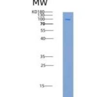 小鼠CD45 / PTPRC重组蛋白aa 453-1152, His & GST tag