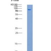 人EphB1 / EPHT2重组蛋白aa 565-984, His & GST tag