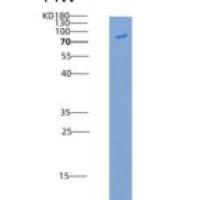 人CD31 / PECAM1重组蛋白Fc tag