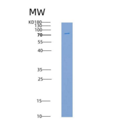 人VEGFR2 / KDR重组蛋白His &GST Tag