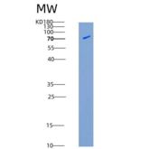人TLK2 / PKU-ALPHA重组蛋白aa 397-772, His & GST tag