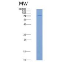 小鼠SRC Kinase / Proto-oncogene c-Src重组蛋白His & GST tag