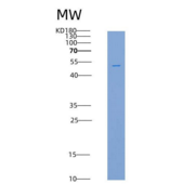 人糖原合酶激酶3β(GSK3b)重组蛋白His tag
