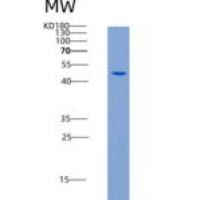 人STK24 / MST3重组蛋白His tag