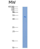 小鼠IFNGR1 / CD119重组蛋白Fc tag