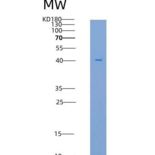 大鼠FCGRT & B2M Heterodimer重组蛋白