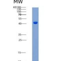 人TLK2 / PKU-ALPHA重组蛋白aa 397-772
