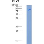 人CSF1R / MCSF Receptor / CD115重组蛋白His & Fc tag