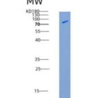 人CSF1R / MCSF Receptor / CD115重组蛋白His & Fc tag