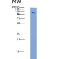 人IGF1R / CD221重组蛋白His tag