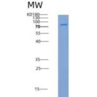 人CSF1R重组蛋白aa 543-922, His &GST Tag
