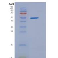大鼠EpCAM / TROP-1 / TACSTD1重组蛋白Fc tag