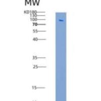人血管细胞粘附分子1(VCAM1)重组蛋白Fc Tag