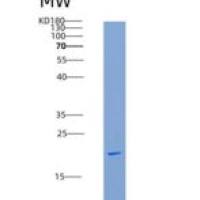 大鼠组织金属蛋白酶抑制因子1(TIMP1)重组蛋白