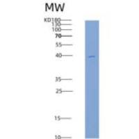 小鼠ERK2 / MAPK1 / MAPK2重组蛋白