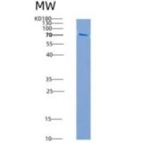 人肝配蛋白B受体2(EPHB2)重组蛋白aa 570-987, His &GST Tag