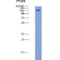 人MARK3 / CTAK1 / EMK-2重组蛋白His & GST tag